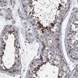 CEP85L Antibody, Novus Biologicals 0.1mL; Unlabeled:Antibodies, Polyclonal